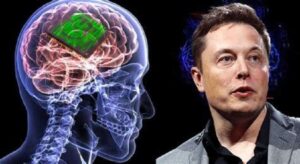 Neuralink implanta el primer chip cerebral en un humano: Musk