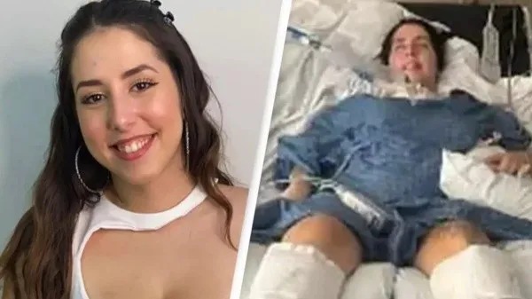 Influencer queda paralizada y al borde de la muerte por comer alimento contaminado